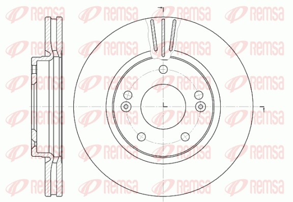 REMSA Első féktárcsa 6667.10_REMSA